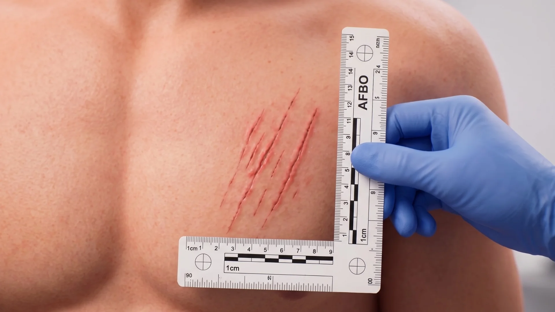 Forensic photo